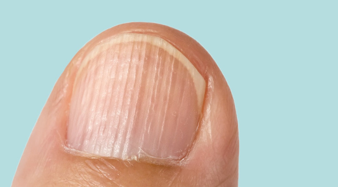 How to Fix Nail Ridges and the Causes Behind Them Daline Nails