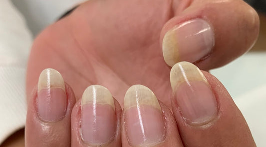 7 Nail Care Tips for Healthy, Strong, Beautiful Nails