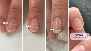 How to prevent ridges and splitting nails from affecting your day