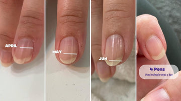 How to prevent ridges and splitting nails from affecting your day