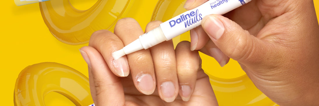 How to Get Rid of Yellow Nails: Tips and Tricks for a Brighter, Whiter Manicure