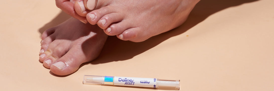 What To Do About Toenail Fungus Under Your Nails