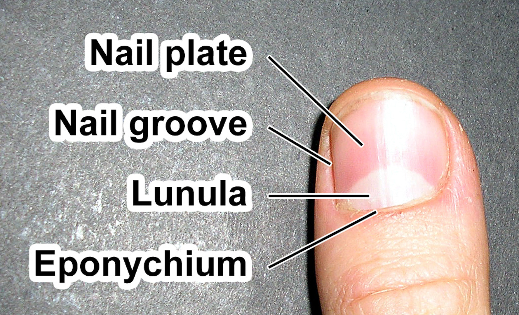 Medical scheme illustration of human finger nail structure | Nail  techniques, Nail tech school, Nail courses