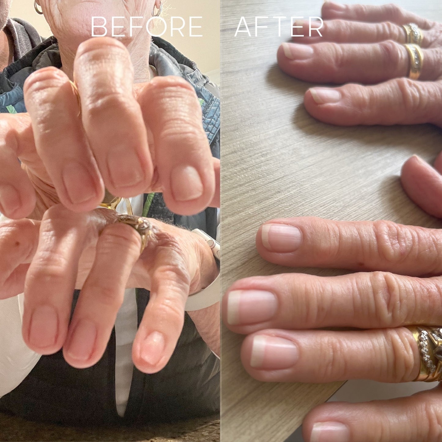 Magic Pen — Repair & Growth Nail Cream (Single Pen)