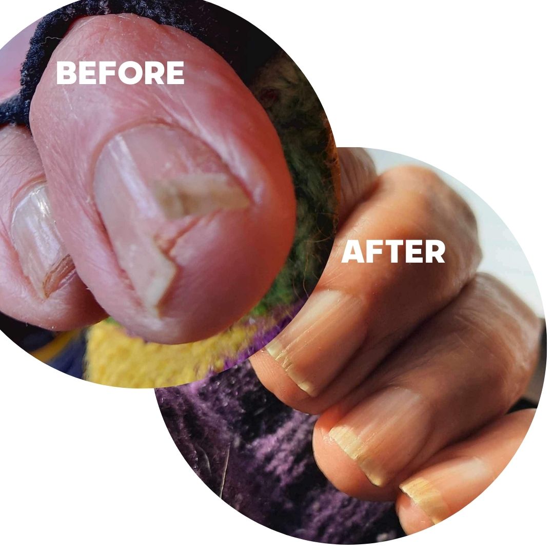 Magic Pen — Repair & Growth Nail Cream (Single Pen)