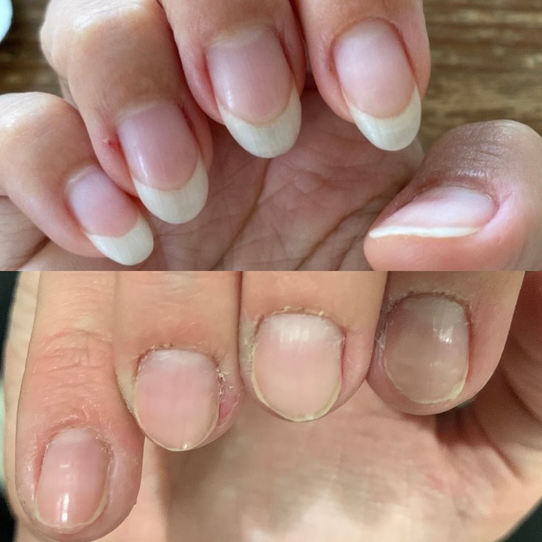 Magic Pen — Repair & Growth Nail Cream (Single Pen)