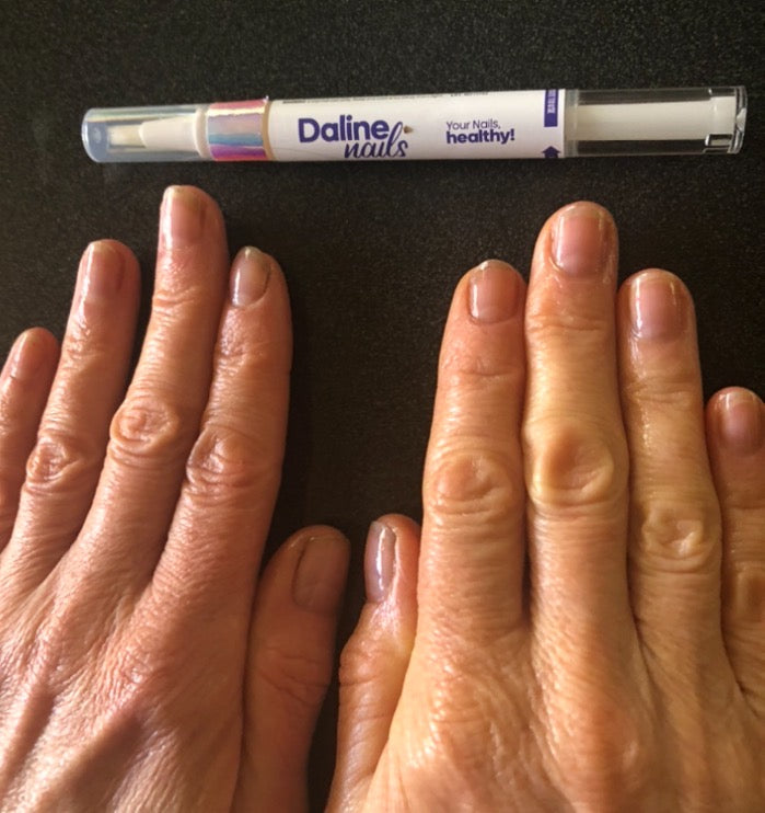 Magic Pen — Repair & Growth Nail Cream (Single Pen)